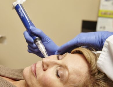 Skinpen-microneedling-to-achieve-youthful-looking-skin