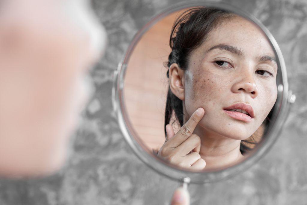 how-to-fix-sun-damaged-skin
