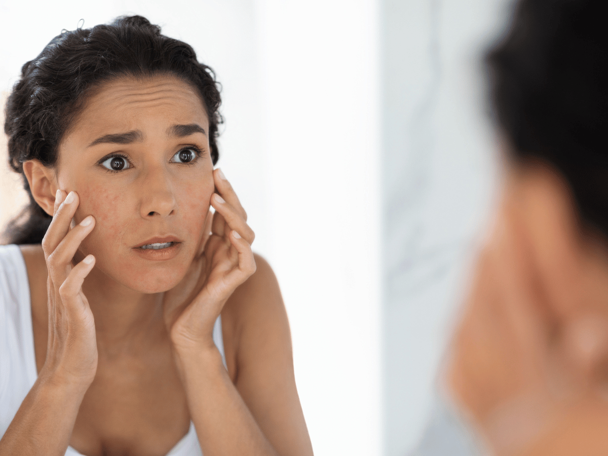 a girl looking at her acne in the mirror