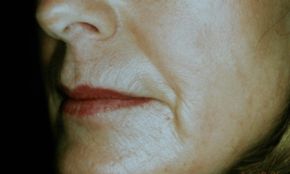 face without wrinkles