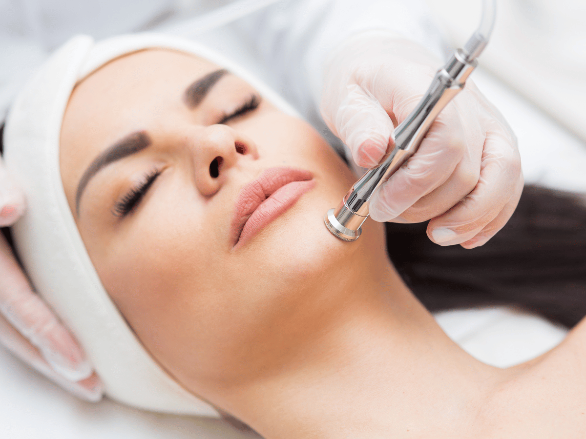 microdermabrasion procedure