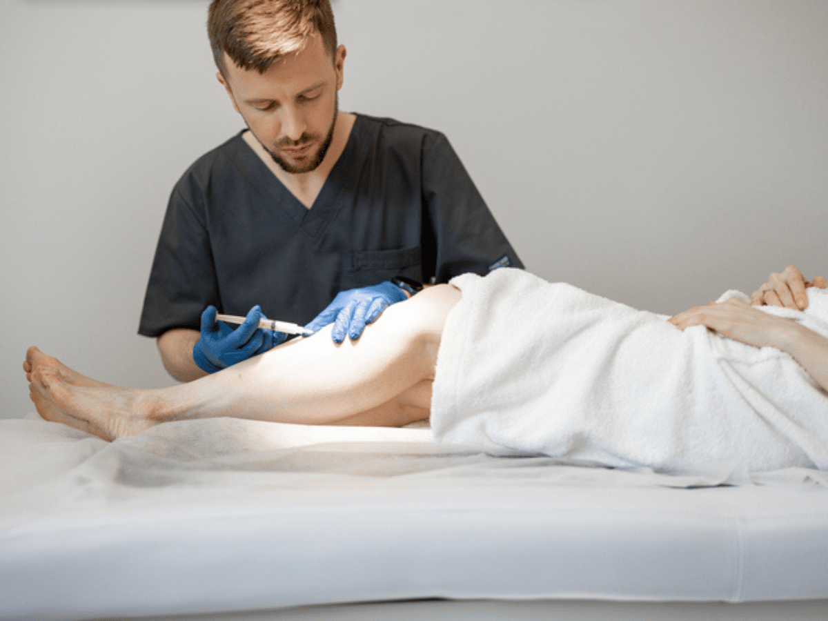 sclerotherapy procedure