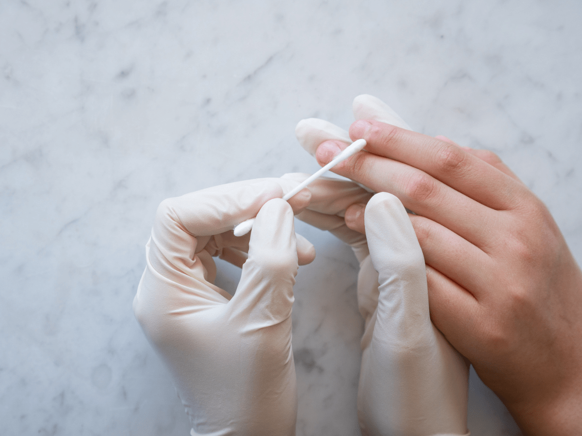 wart treatment on hands